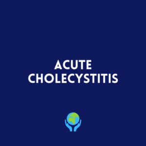 Acute Cholecystitis