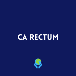 Ca Rectum