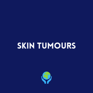 Skin Tumours
