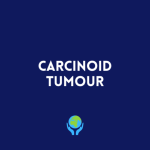 Carcinoid Tumour