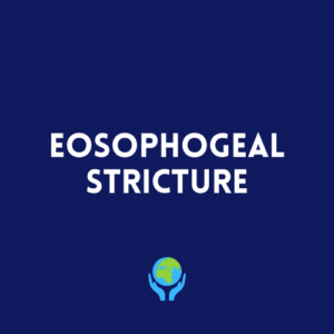 Eosophogeal Stricture