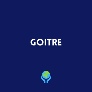 Goitre