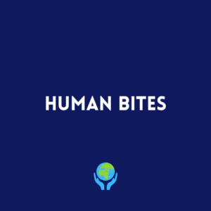 Human Bites
