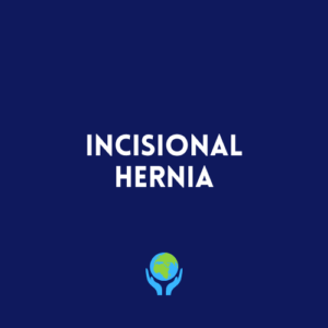 Incisional Hernia