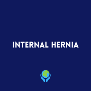 Internal Hernia
