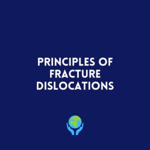 Principles of Fracture Dislocations