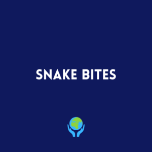 Snake Bites