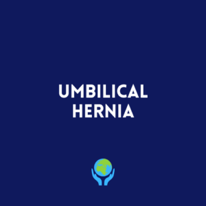 Umbilical Hernia