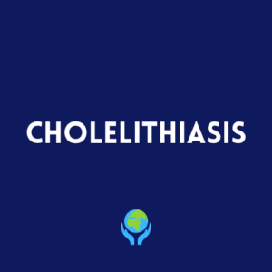 Cholelithiasis