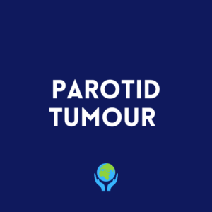 Parotid Tumour